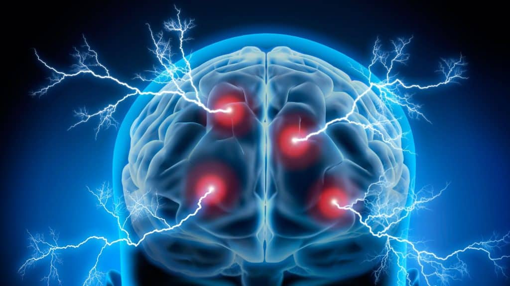 Ilustración de un cerebro humano con cuatro puntos rojos brillantes y rayos eléctricos que representan la actividad neuronal o eléctrica.